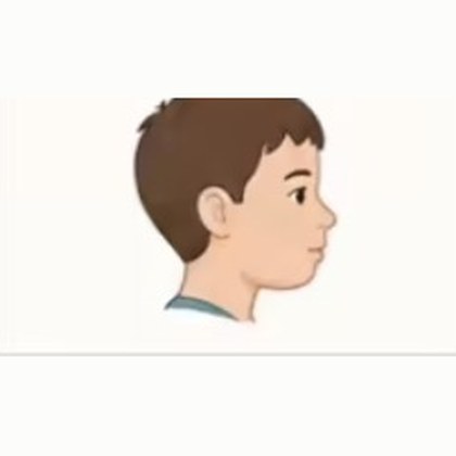 Congenital Abnormality — score 2: Moderate